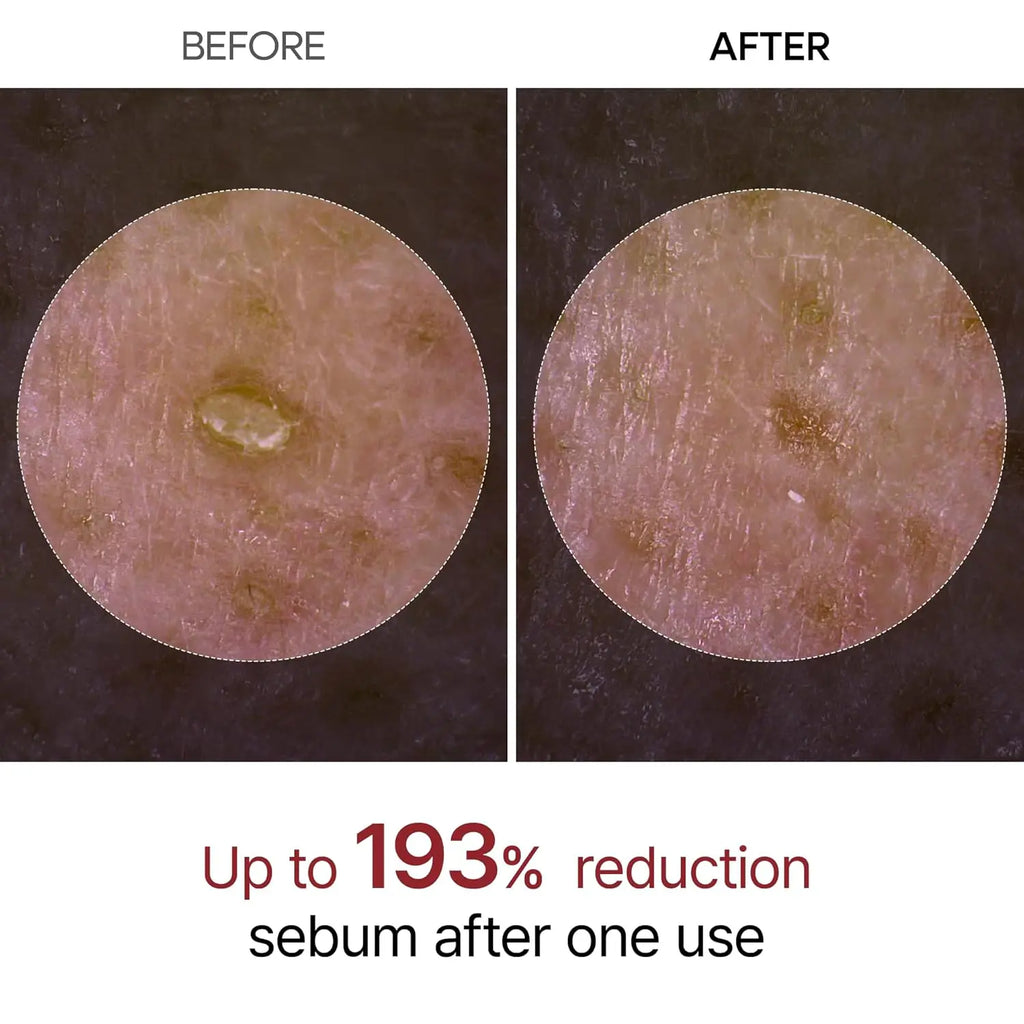80ml 2-Pack Rice Peeling Ampoule Peel Shot Glow - Soft Exfoliating Scrub, Facial & Body Dead Skin Blackhead Remover All Skin Fri